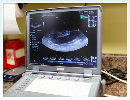 Ultrasound Valley Village, CA